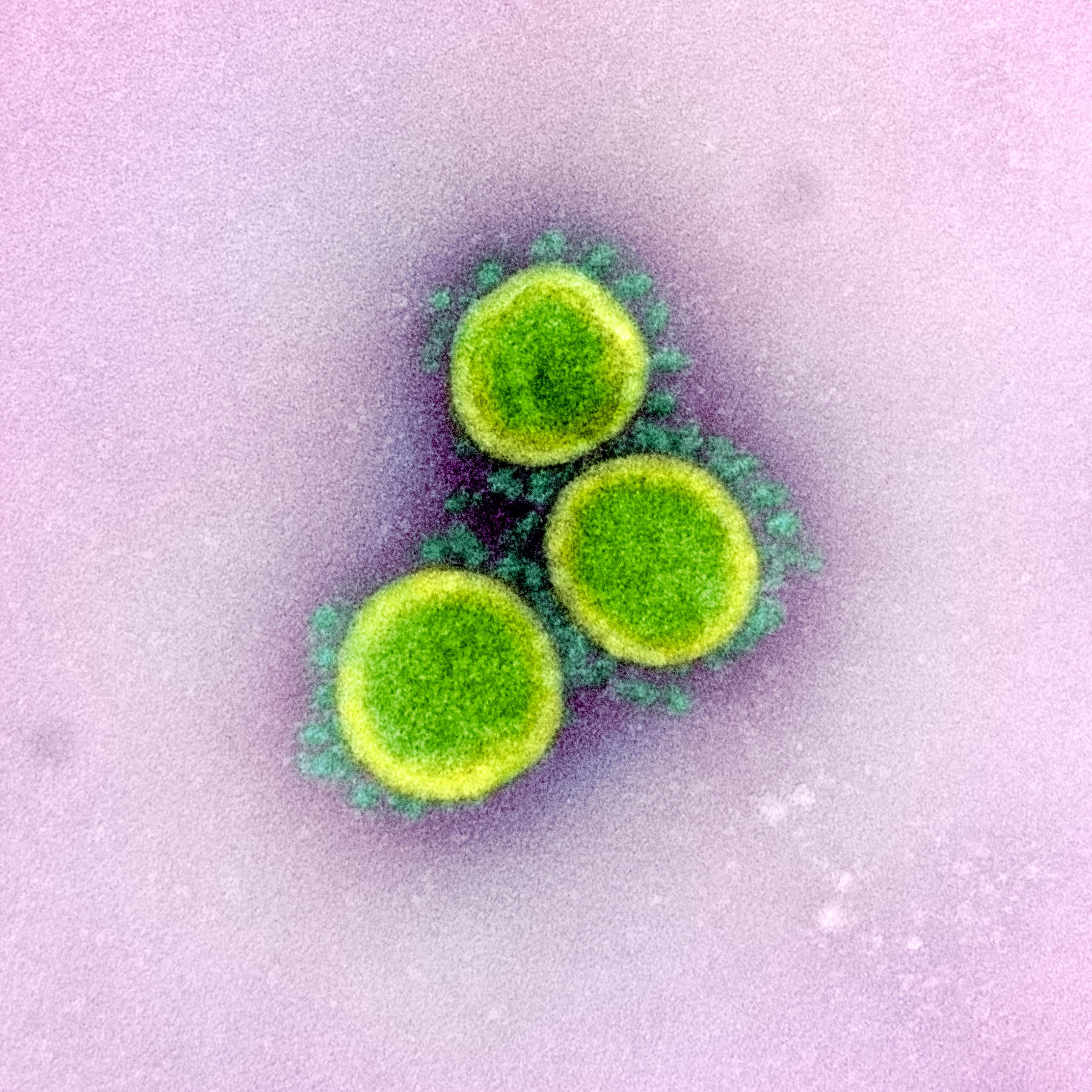 Color-enhanced electron micrograph of SARS-CoV-2 particles from NIAID